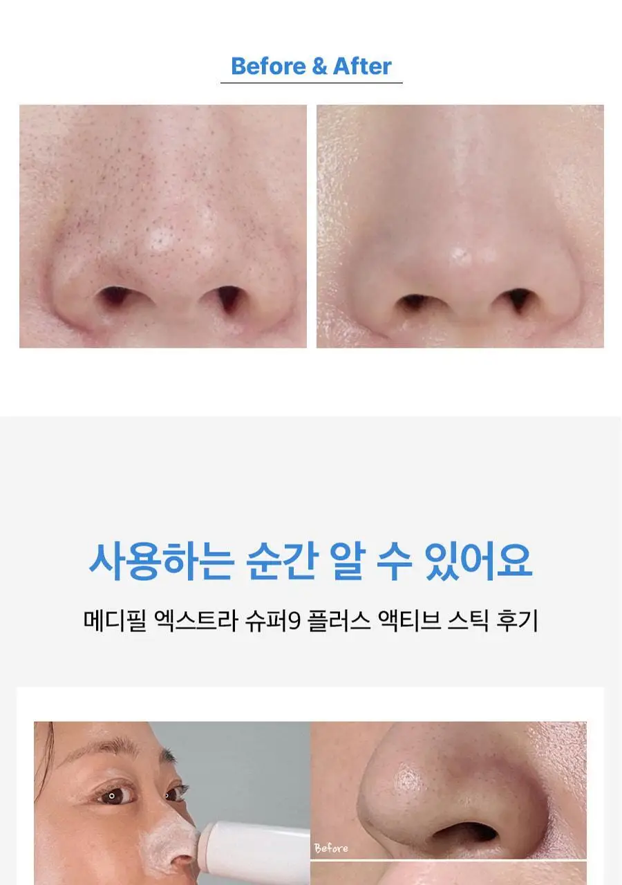 [블랙헤드제거] 메디필 엑스트라 슈퍼9 액티브 스틱 상세페이지 12
